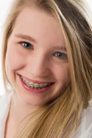 Teenage girl with braces
